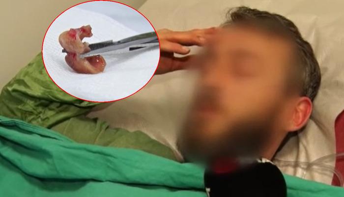 Aynaya baktığında şok olan uykudan dayanılmaz öksürük ile uyandı! Geceleri uyurken ilginç olay oldu