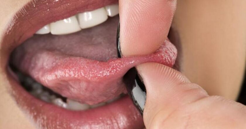 Diliniz genellikle duyarsızsa, bu sebep olabilir! Dil uyuşma dili nedir, neden? İntarpidin dilde belirtileri nelerdir, nasıl?